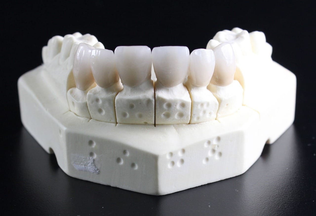 Fused deep learning classified early enamel caries with high accuracy