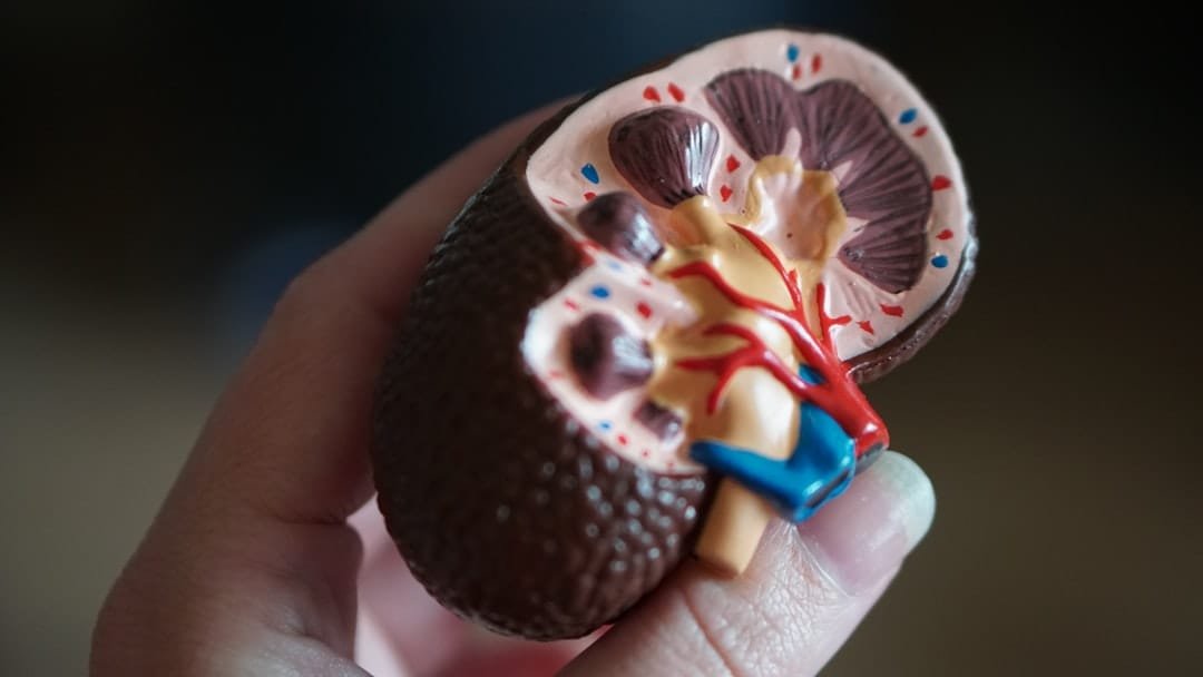 Swiss cohort links kidney stones to diabetes and family history