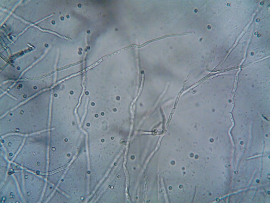 Fermentation changed soybean composition and microbial counts