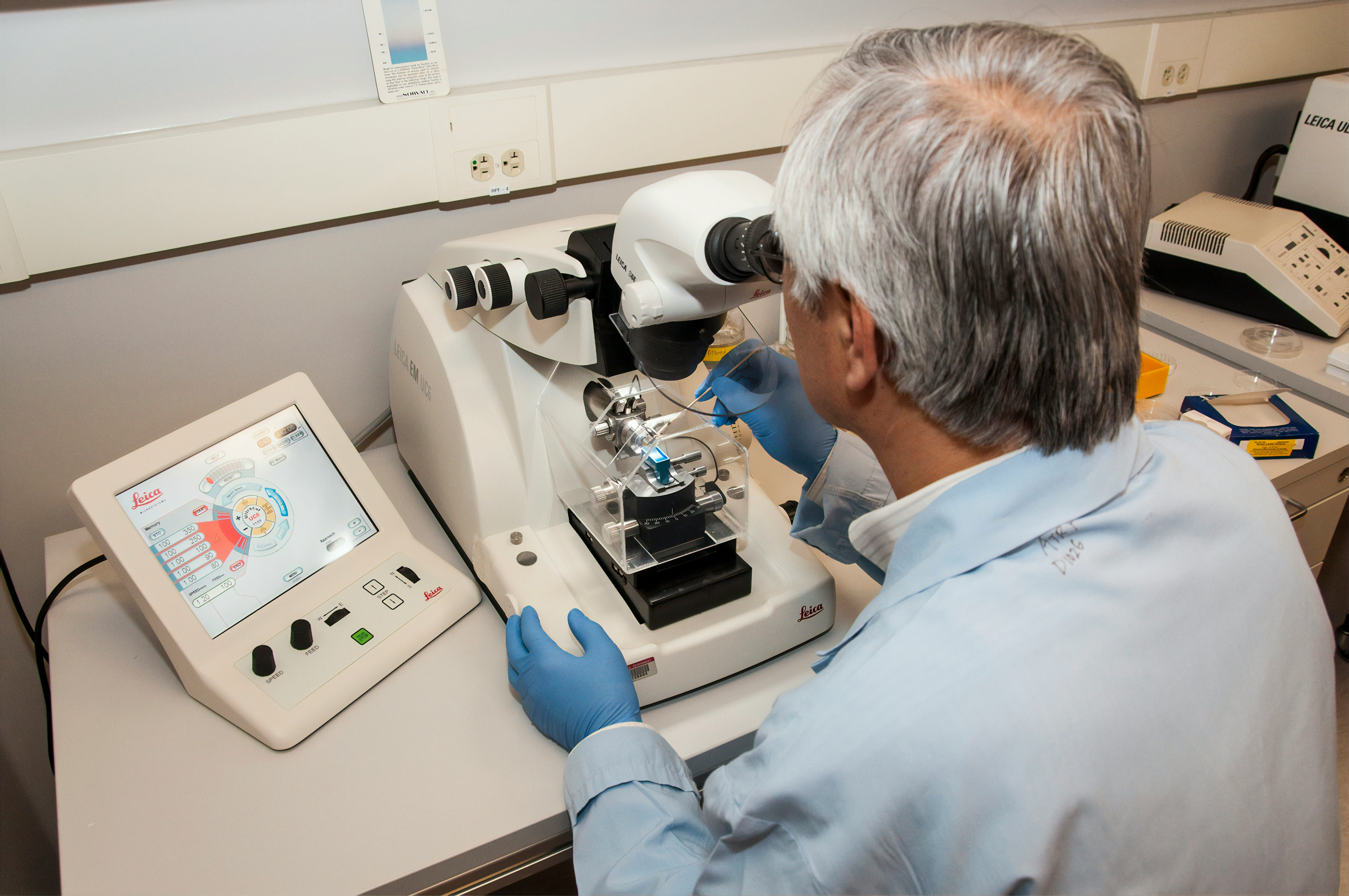C. elegans lifespan is limited by different competing causes of death