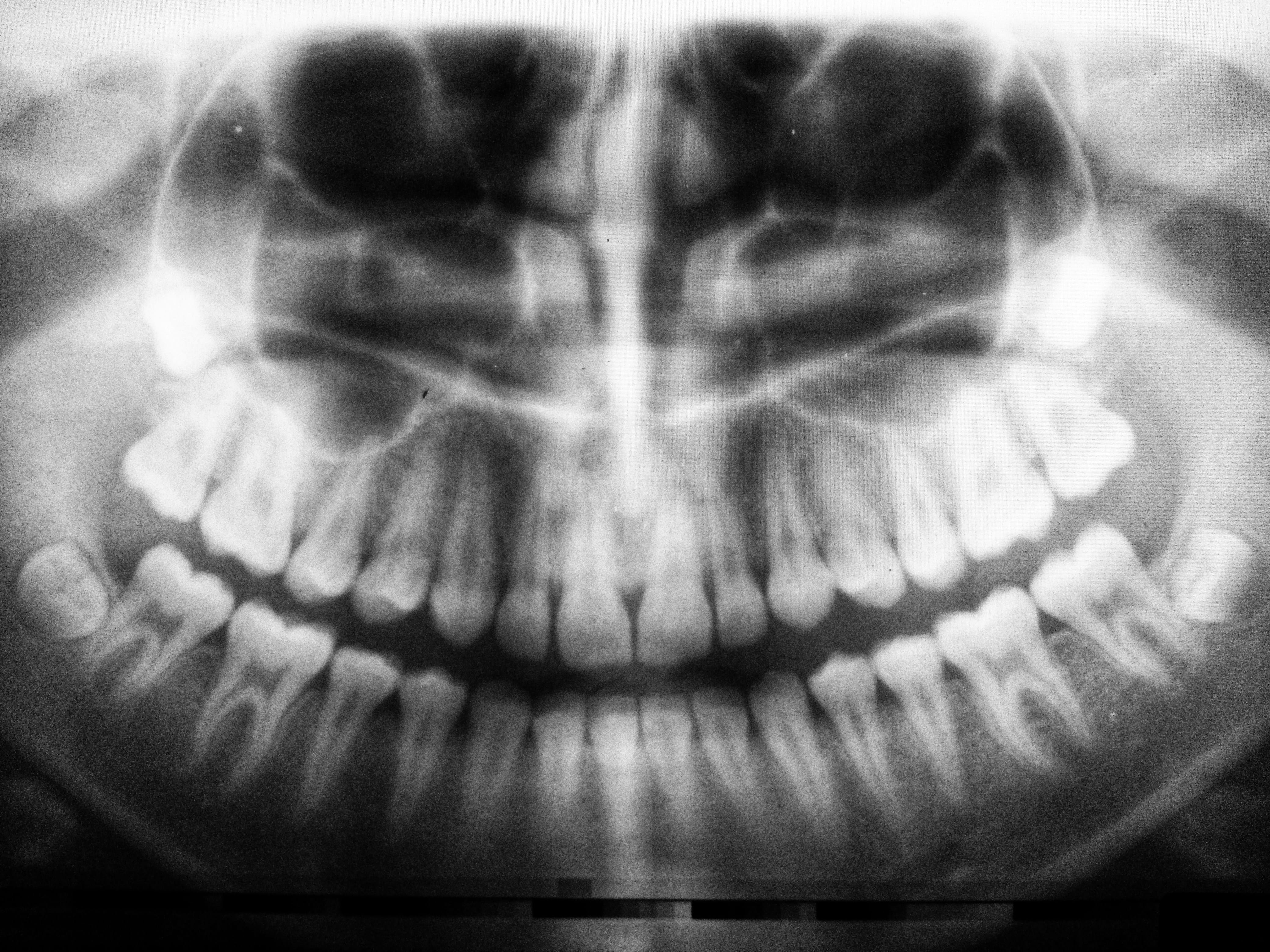Multimodal imaging supports orthodontic diagnosis and collaborative oral care