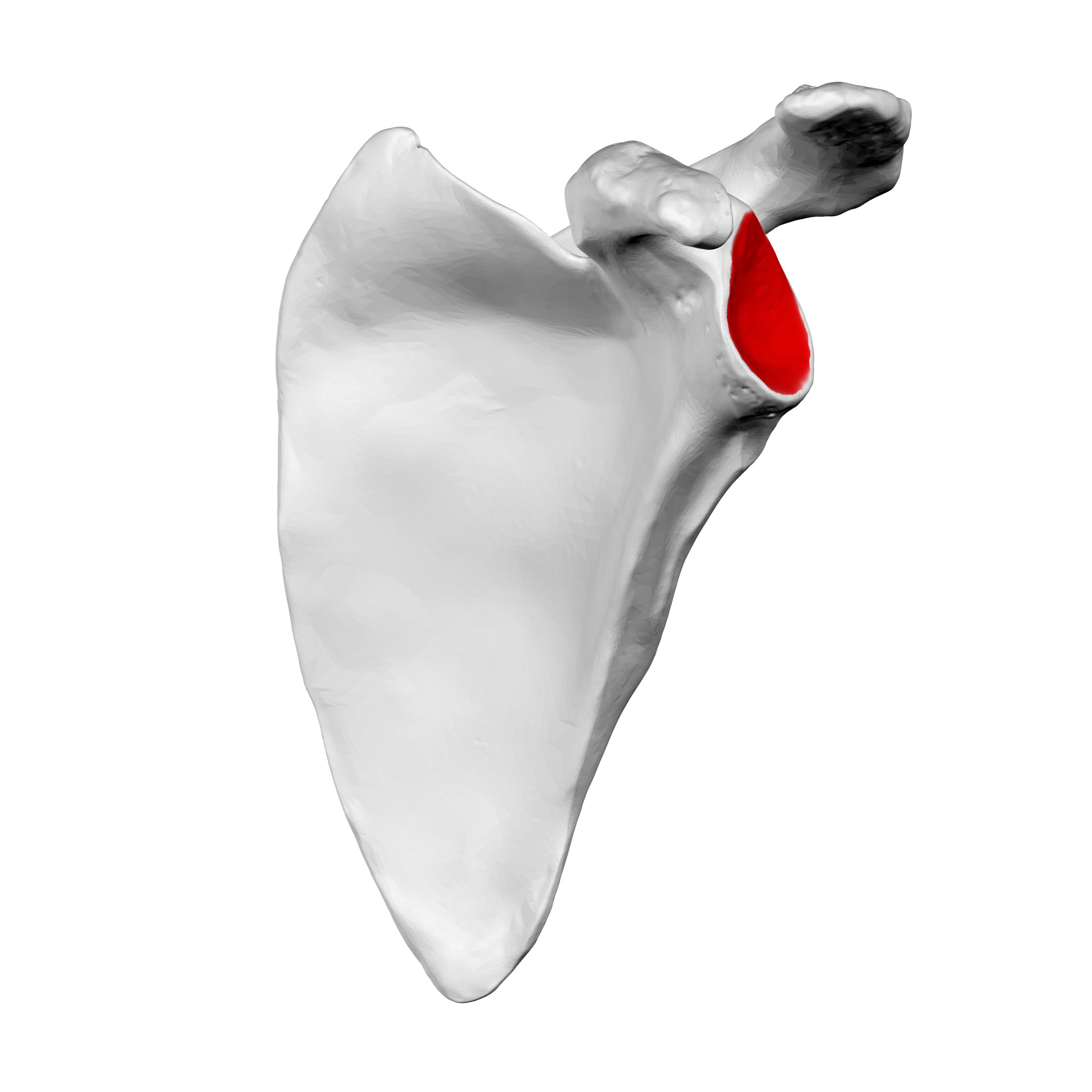 Latarjet and allograft revision outperformed soft tissue repair