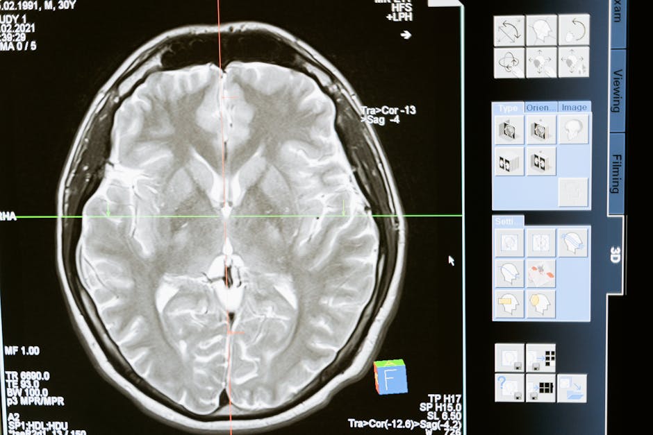 Successful transplant linked to slower brain volume loss in adults with sickle cell disease